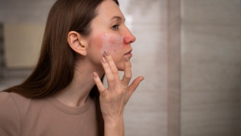 The Perfect Daily Routine for Sensitive Skin